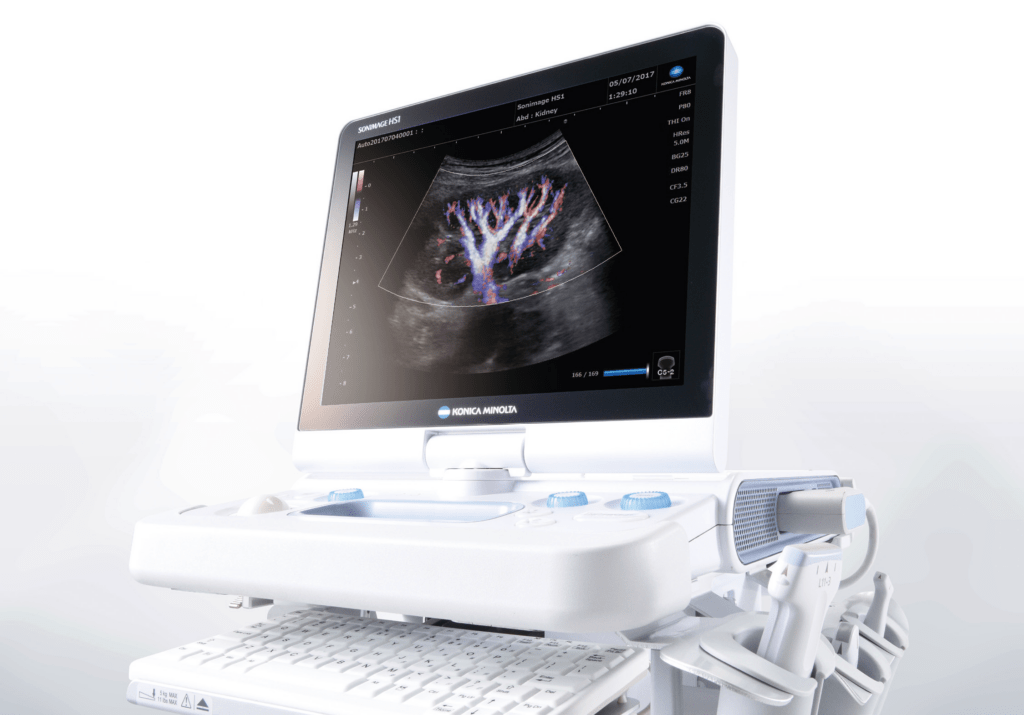 Billeddiagnostisk udstyr til kiropraktorer og fysioterapeuter - Ultralyd - Konica Minolta